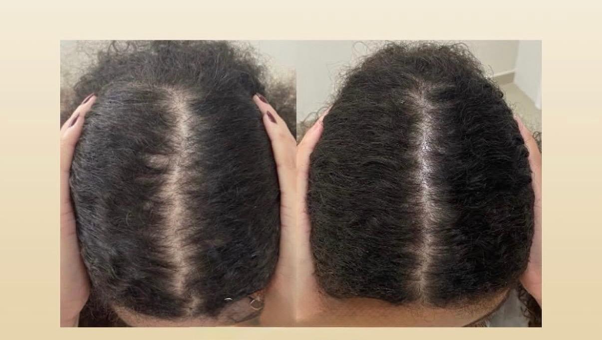 Volume recuperado